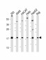 CDKN2B Antibody (C-term)