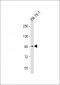 SSH3 (Ser37) Antibody