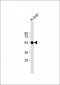 FADS2 Antibody