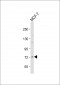 Raf1 (Ser296) Antibody