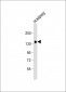 KL Antibody (Center)