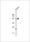 FADS2 Antibody