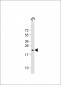 VHL Antibody (N-term)