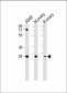 IGFBP4 Antibody (N-term)