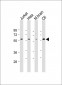 AKT2 Antibody