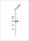 T Antibody (N-term)