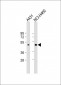 T Antibody (N-term)