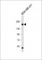 THBS1 Antibody (C-Term)