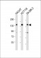 MST1R Antibody (Center)