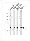 CKS2 Antibody (C-Term)