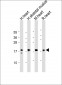 MYL2 Antibody (Center)