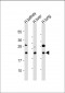 BCL2L10 Antibody (Center)