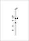 KRT10 Antibody (N-term)