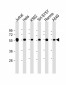 CALR Antibody (Center)