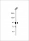 B-RAF Antibody (S445)