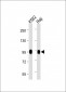 B-RAF Antibody (S445)