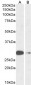 Goat Anti-ASCL1 (aa79-91) Antibody