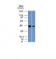 Anti-NDRG1 (Marker of Tumor Aggressiveness) Antibody