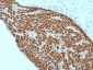 Anti-CDX2 (GI Epithelial Marker) Antibody