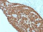 Anti-CDX2 (GI Epithelial Marker) Antibody