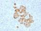 Anti-Chromogranin A / CHGA Antibody