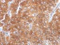 Anti-Adipophilin / Perilipin-2 (Marker of Obesity) Antibody