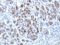 Anti-Alpha-1-Antichymotrypsin (SERPINA3) (Histiocytoma Marker) Antibody