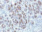 Anti-Alpha-1-Antichymotrypsin (SERPINA3) (Histiocytoma Marker) Antibody