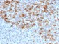 Anti-Alpha-1-Antichymotrypsin (SERPINA3) (Histiocytoma Marker) Antibody