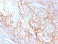 Anti-Catenin, beta (p120) Antibody