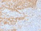 Anti-Catenin, beta (p120) Antibody