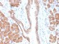 Anti-Catenin, beta (p120) Antibody