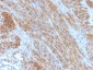 Anti-Desmin Antibody