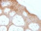 Anti-Desmoglein-1 (DSG1) Antibody