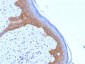 Anti-Desmoglein-3 Antibody