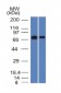 Anti-Endoglin / CD105 Antibody