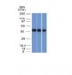 Anti-NSE gamma Antibody