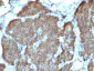 Anti-NSE gamma Antibody