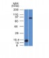 Anti-Factor XIIIa Antibody