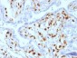 Anti-Factor XIIIa Antibody