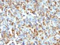 Anti-Factor XIIIa Antibody