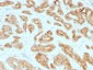Anti-AMACR / p504S (Prostate Cancer Marker) Antibody