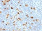 Anti-CD15 / FUT4 (Reed-Sternberg Cell Marker) Antibody