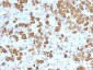 Anti-Growth Hormone Antibody