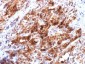 Anti-Glypican-3 (GPC3) (Hepatocellular Carcinoma Marker) Antibody