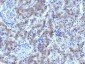 Anti-Glypican-3 (GPC3) (Hepatocellular Carcinoma Marker) Antibody