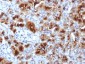 Anti-GP2 (Glycoprotein 2) / ZAP75 Antibody