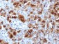 Anti-GP2 (Glycoprotein 2) / ZAP75 Antibody