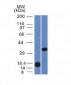 Anti-Galectin-13 (GAL13) / Placental Protein 13 (PP13) Antibody