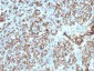 Anti-HLA-DP/-DQ/-DR (MHC II) Antibody